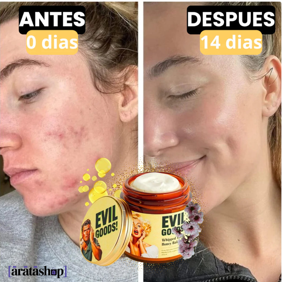 Evil Goods- Bálsamo sebo de res anti acné y anti envejecimiento 🧖✨